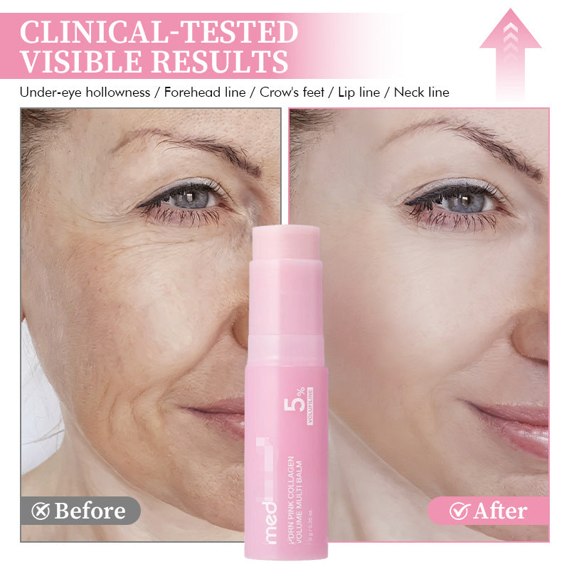 Volufiline PDRN Protein Plumping Stick